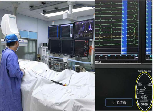 二胎准妈妈心律失常市中医院这个手术解除了她的心病